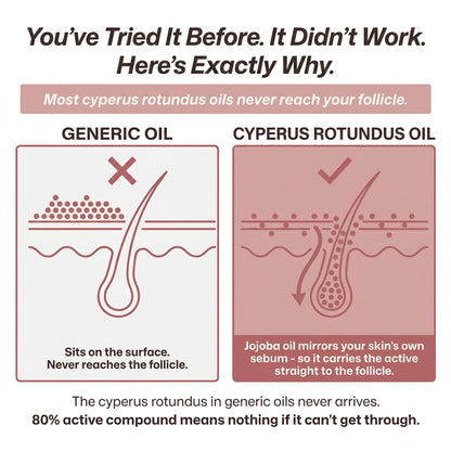 Cyperus rotundus oil for unwanted hair - slower, finer regrowth